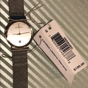 Skagen watch 🌟